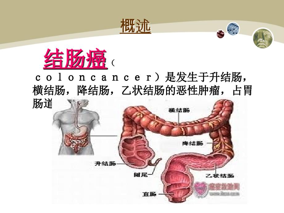 结肠癌护理查房肿瘤内科.ppt_第3页