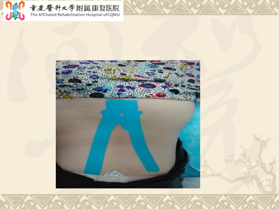 肌内效贴布法PPT课件.ppt_第2页