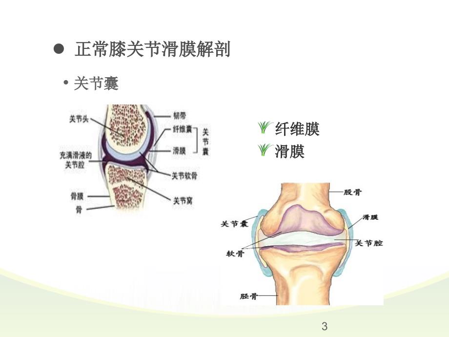 膝关节滑膜病变MRI表现PPT课件.ppt_第3页