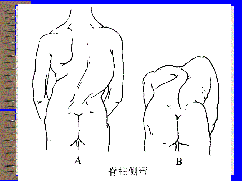 脊柱和四肢的检查PPT课件.ppt_第3页