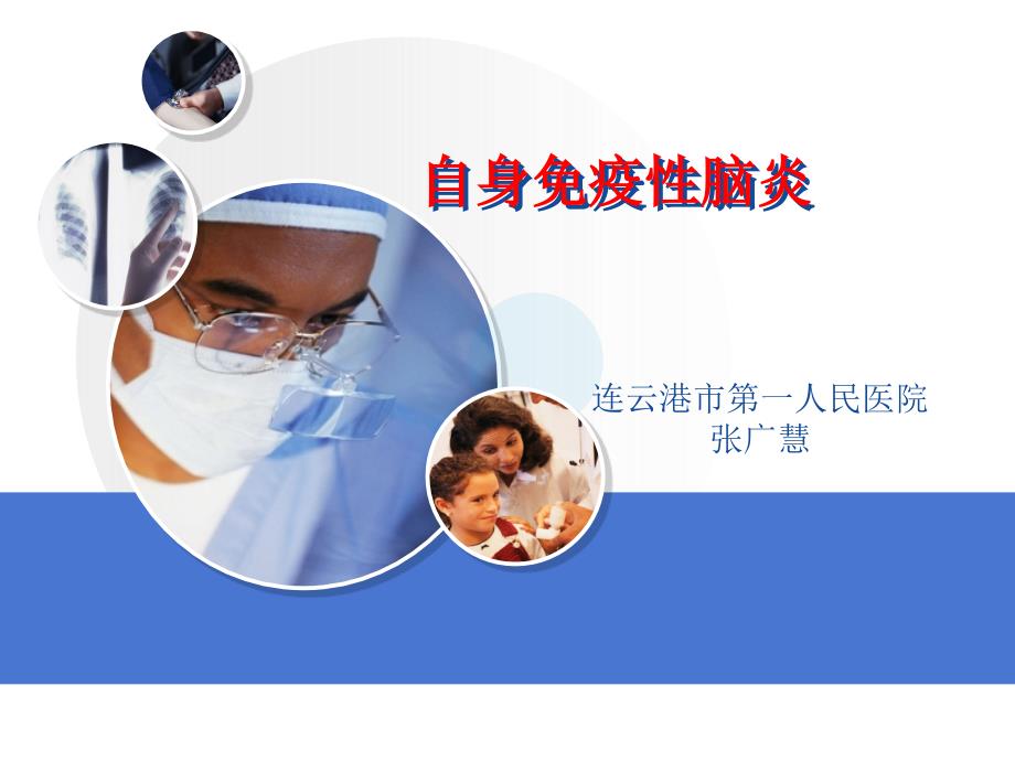 自身免疫性脑炎课件.ppt_第1页