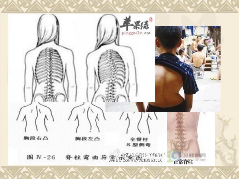 预防脊柱弯曲异常.ppt_第3页