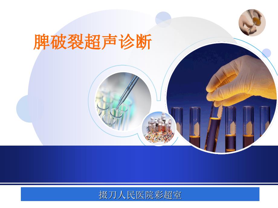 脾破裂的超声诊断.ppt_第1页