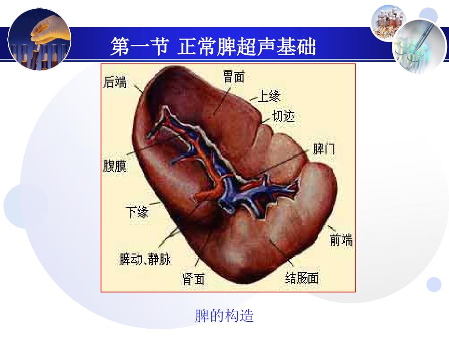 脾破裂的超声诊断.ppt_第2页