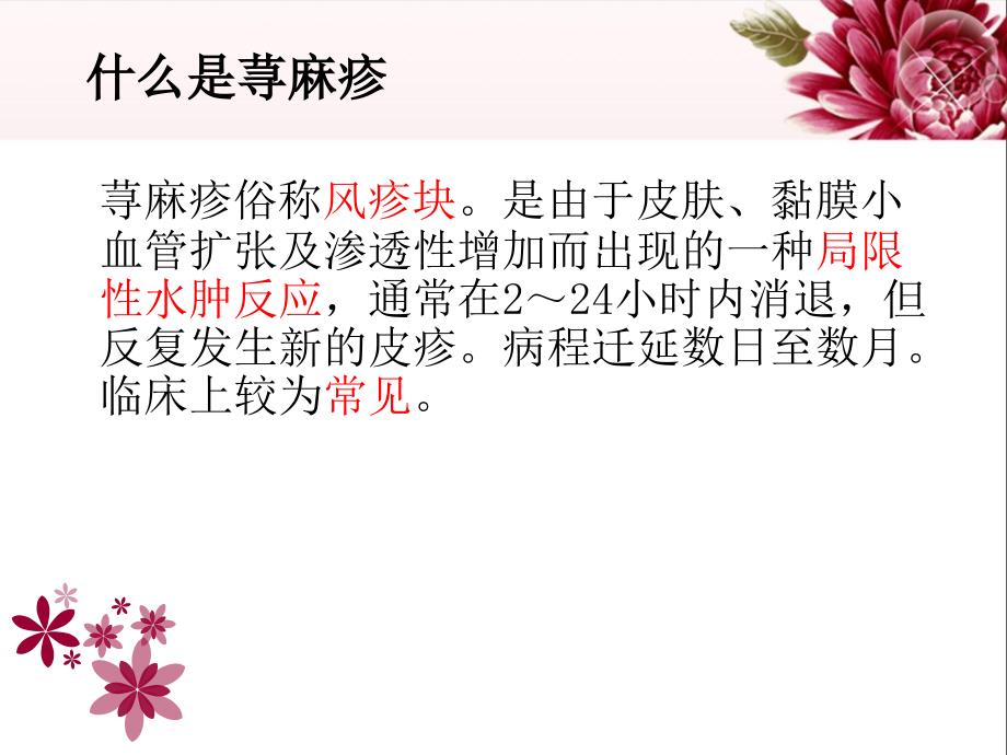 荨麻疹的护理PPT课件.ppt_第2页