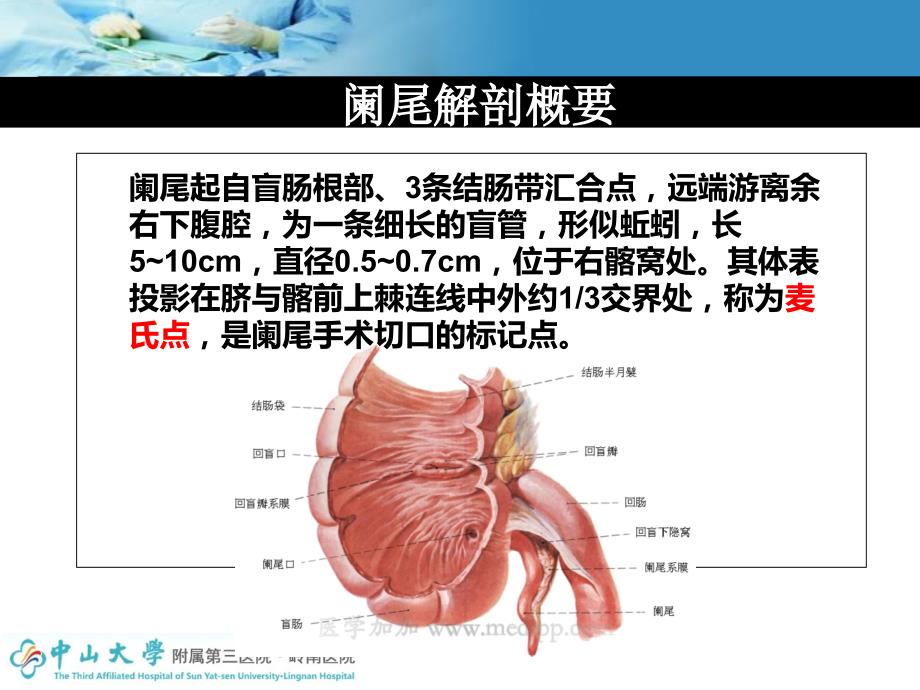 腹腔镜阑尾切除术护士配合课件.ppt_第3页