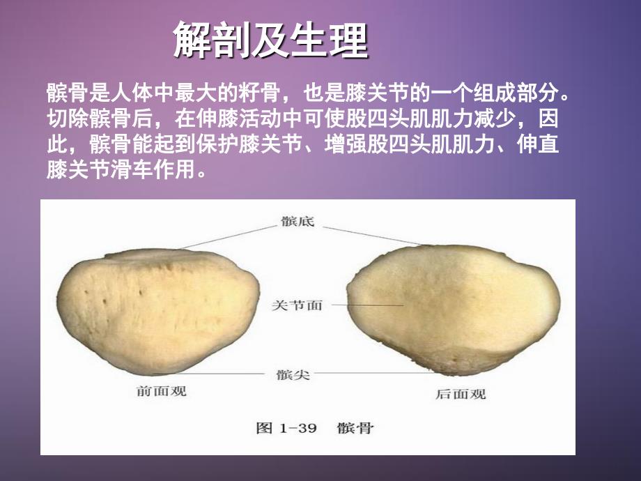 髌骨骨折护理查房.ppt_第3页