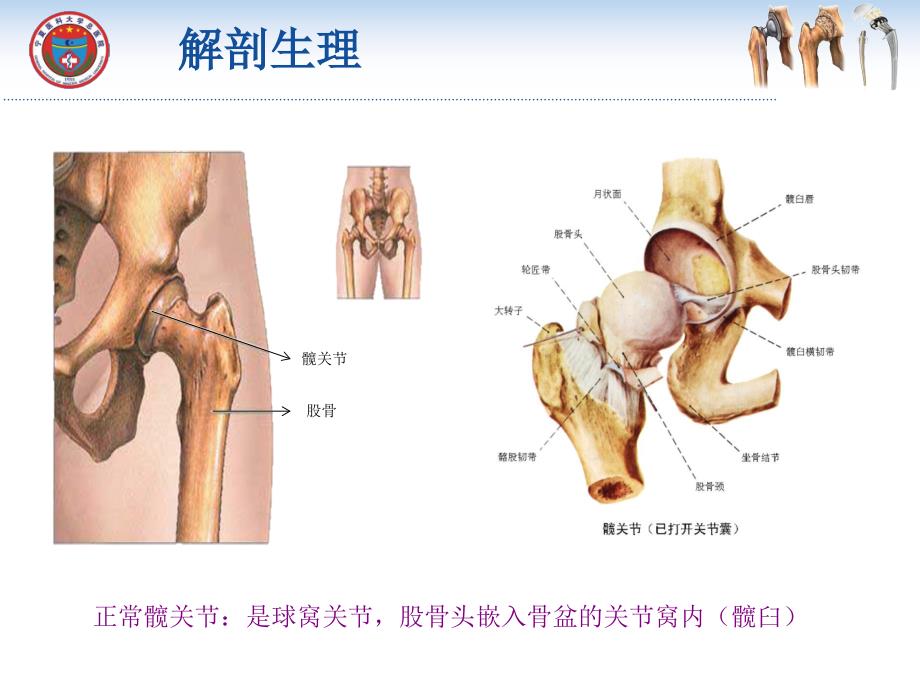 髋关节置换术后功能锻炼PPT课件.ppt_第3页