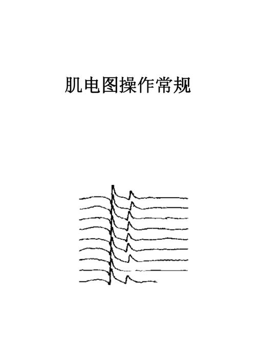 肌电图操作常规.doc