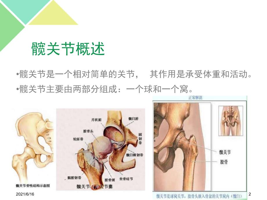 髋关节置换术后护理PPT课件.ppt_第2页