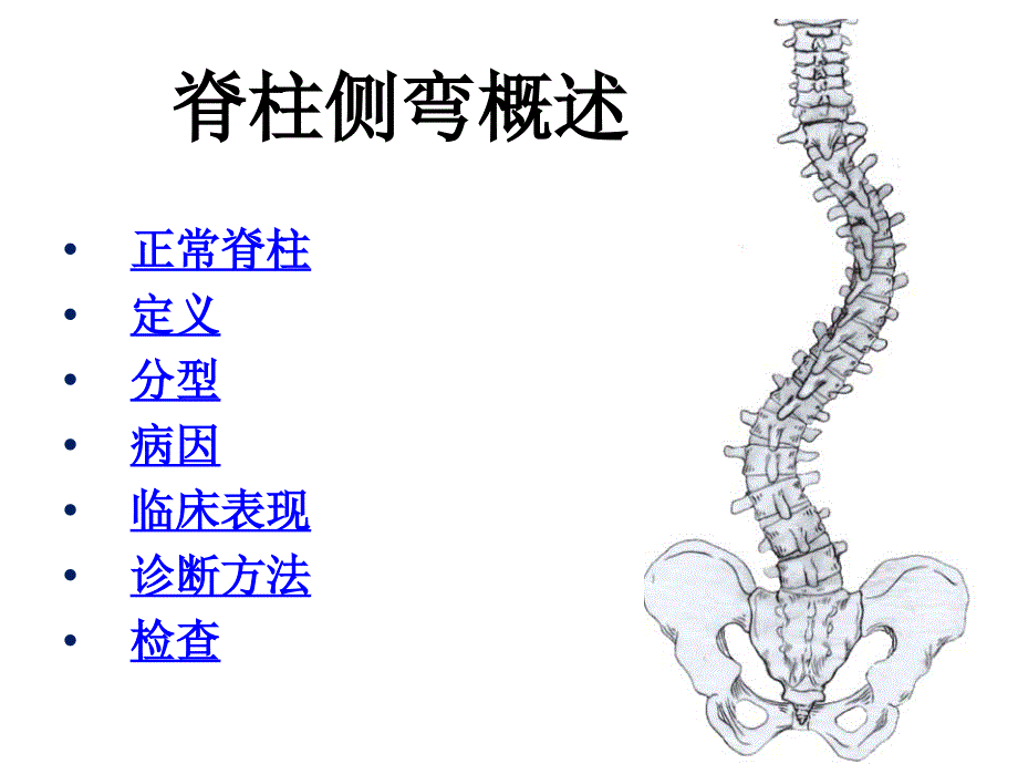 脊柱侧弯概述ppt课件.ppt_第1页