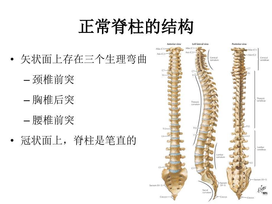 脊柱侧弯概述ppt课件.ppt_第3页