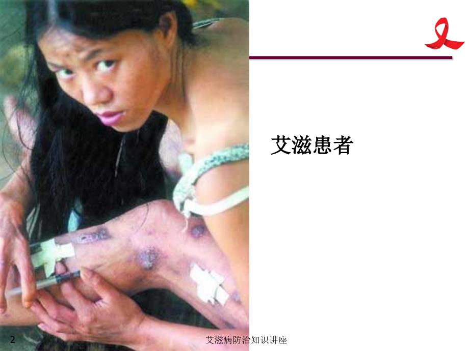艾滋病防治知识讲座课件.ppt_第2页