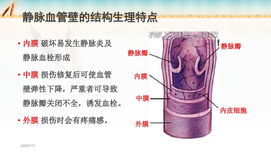 静脉炎ppt课件.pptx_第3页
