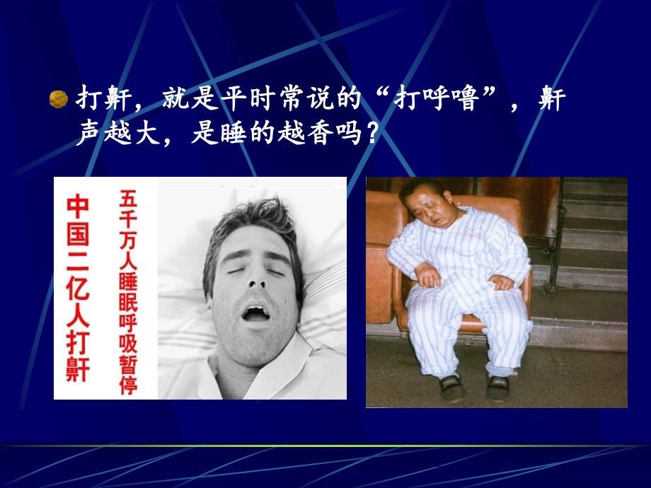 鼾声响并非睡得香ppt课件.ppt_第2页