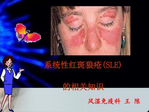 系统性红斑狼疮业务学习.ppt