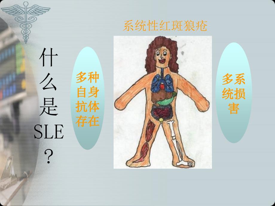 系统性红斑狼疮业务学习.ppt_第3页