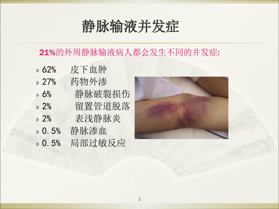 静脉炎的预防和处理.ppt_第2页