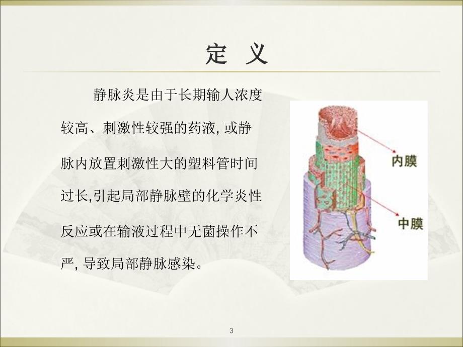 静脉炎的预防和处理.ppt_第3页