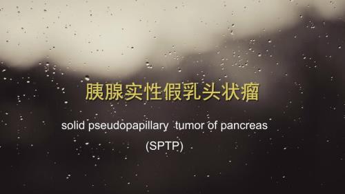 胰腺实性假乳头状瘤课件.ppt