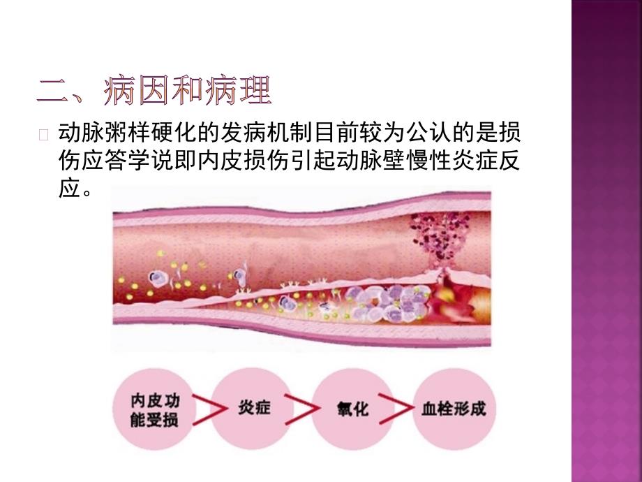 颈动脉硬化闭塞症PPT课件.pptx_第3页