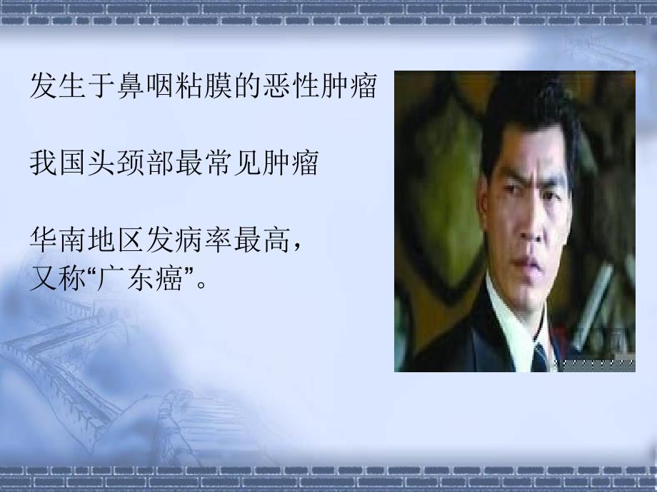 鼻咽癌诊治彭小波PPT课件.ppt_第2页