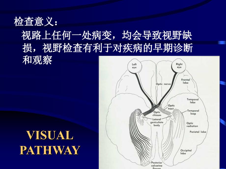视野计及其检查判读方法.ppt_第3页