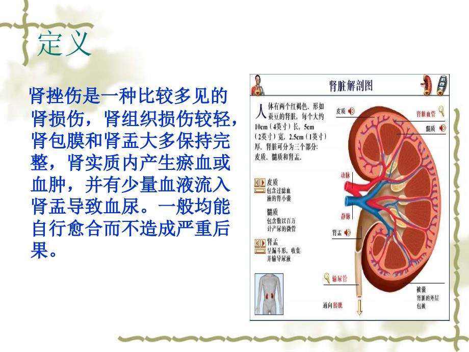 肾挫伤病人的护理查房课件.ppt_第2页
