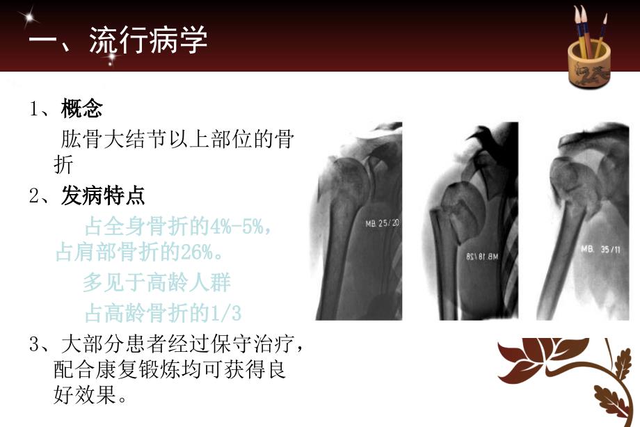 肱骨近端骨折课件.ppt_第3页