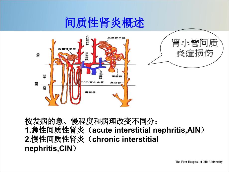 间质性肾炎课件.pptx_第2页