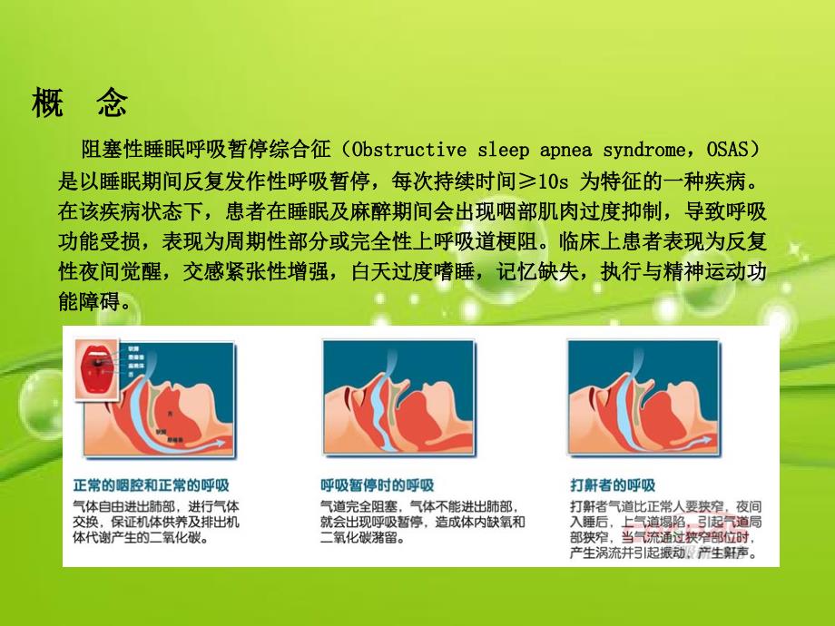 阻塞性睡眠呼吸暂停综合征患者的麻醉管理PPTPPT课件.ppt_第3页