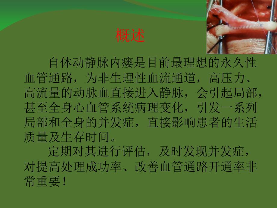 自体动静脉内瘘并发症处理.ppt_第2页