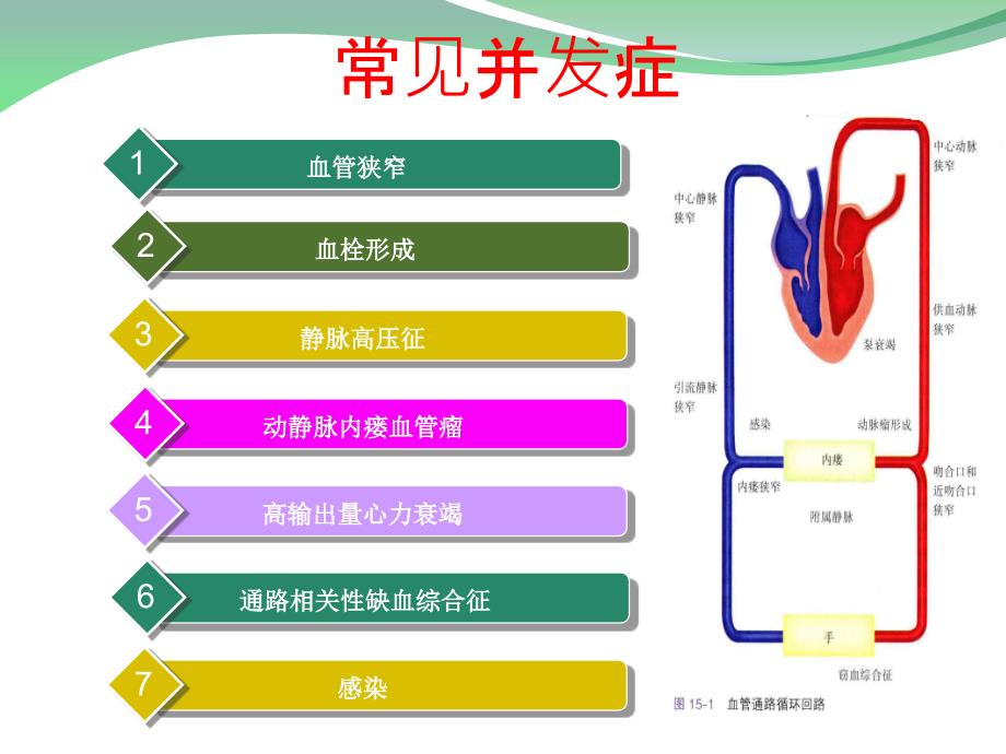 自体动静脉内瘘并发症处理.ppt_第3页