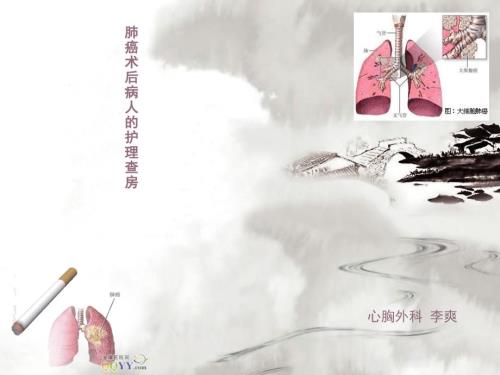 肺癌患者护理查房PPT课件.ppt