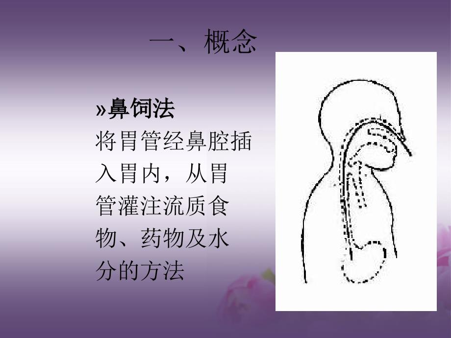 鼻饲法操作PPT.ppt_第3页