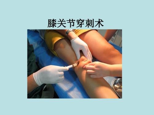 膝关节穿刺术ppt课件.ppt