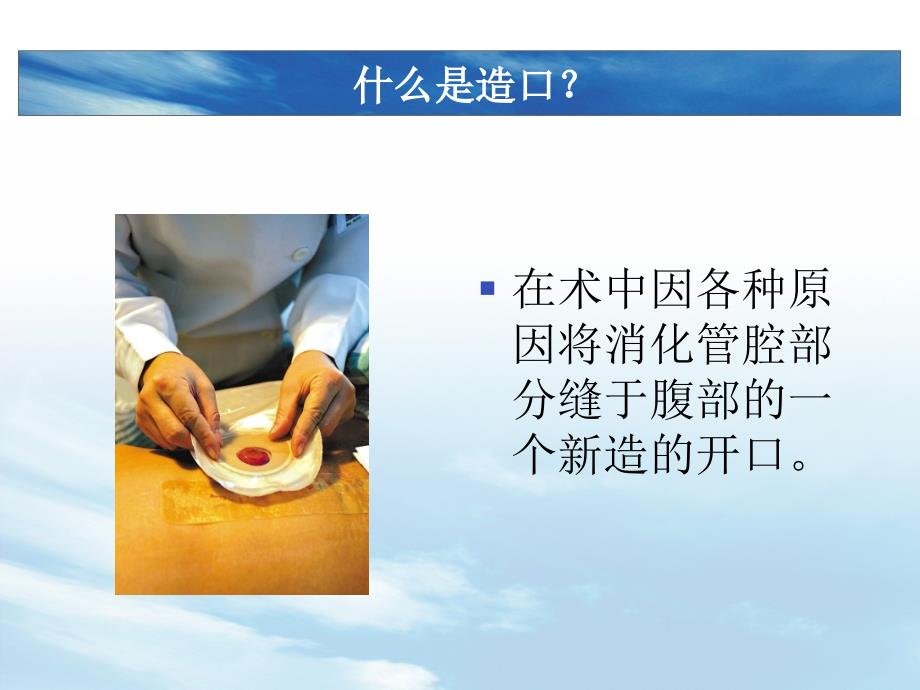 造口病人的护理PPT课件.ppt_第3页