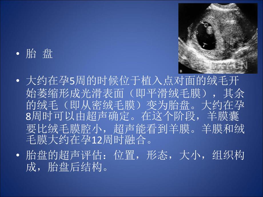 胎盘与脐带异常PPT课件.ppt_第2页