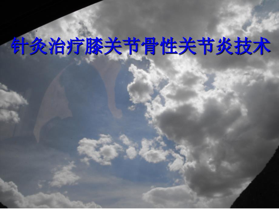 针灸治疗膝关节骨性关节炎ppt课件.ppt_第1页
