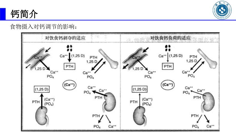 高钙血症0123ppt课件.ppt_第3页