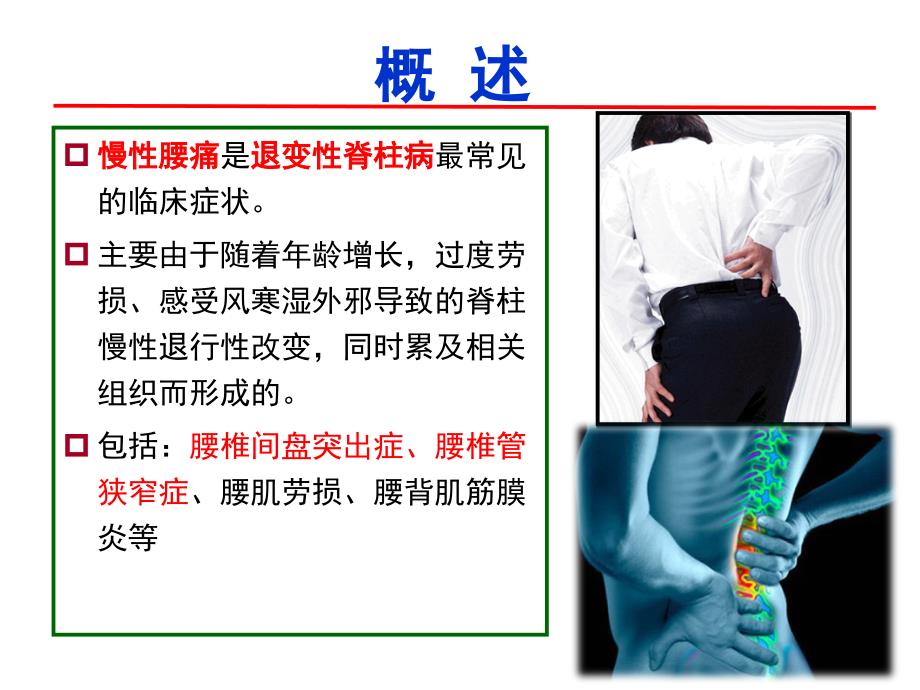 腰腿痛的中医康复治疗.ppt_第2页
