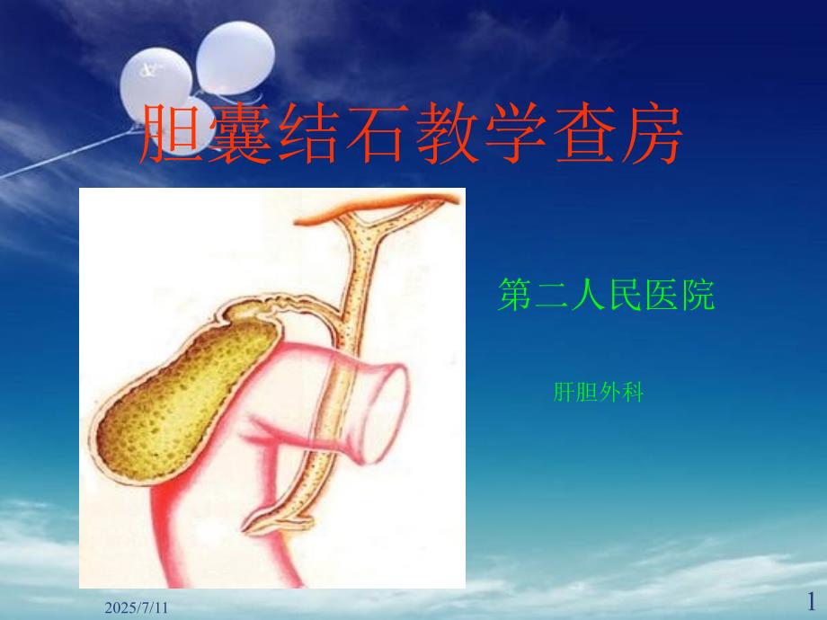 胆囊结石伴胆囊炎PPT课件.ppt_第1页