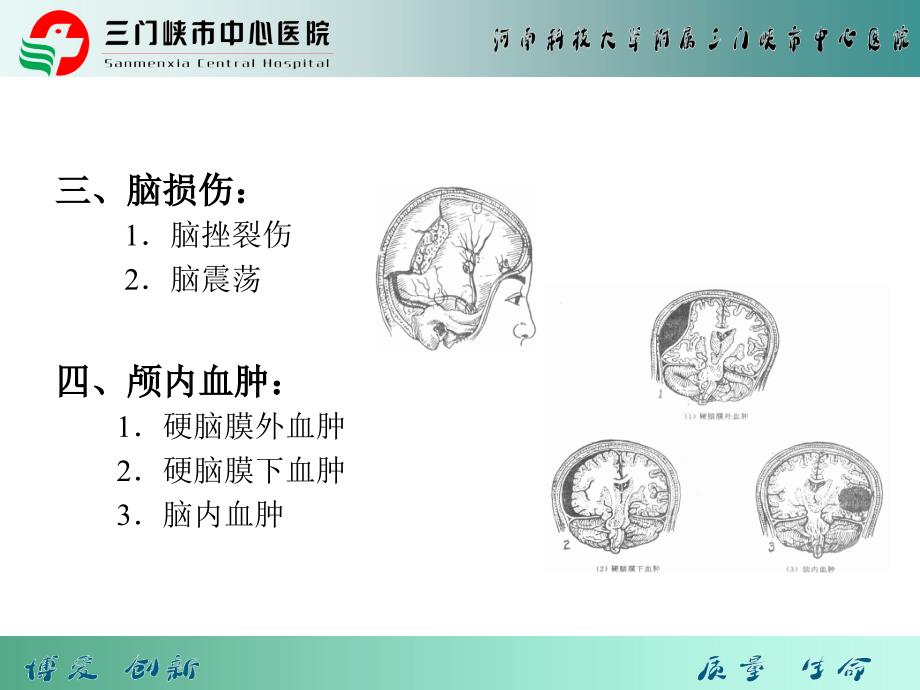 颅脑损伤患者健康宣教.ppt_第3页