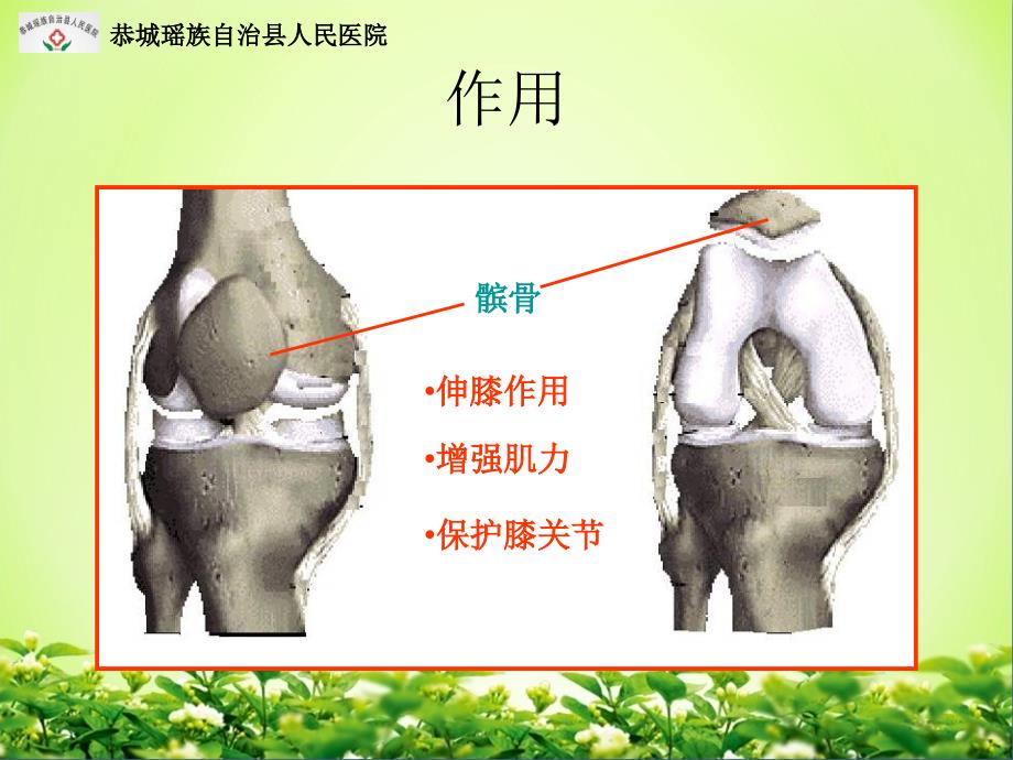 髌骨骨折PPT课件.ppt_第3页