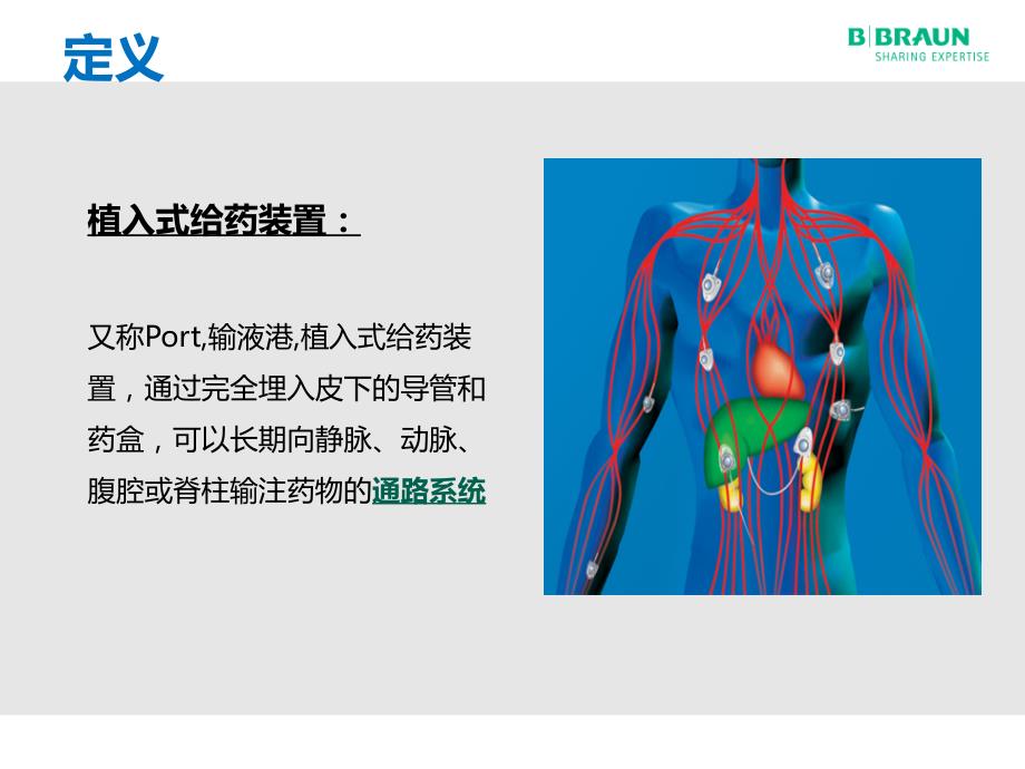 输液港术后维护及并发症处理.ppt_第3页