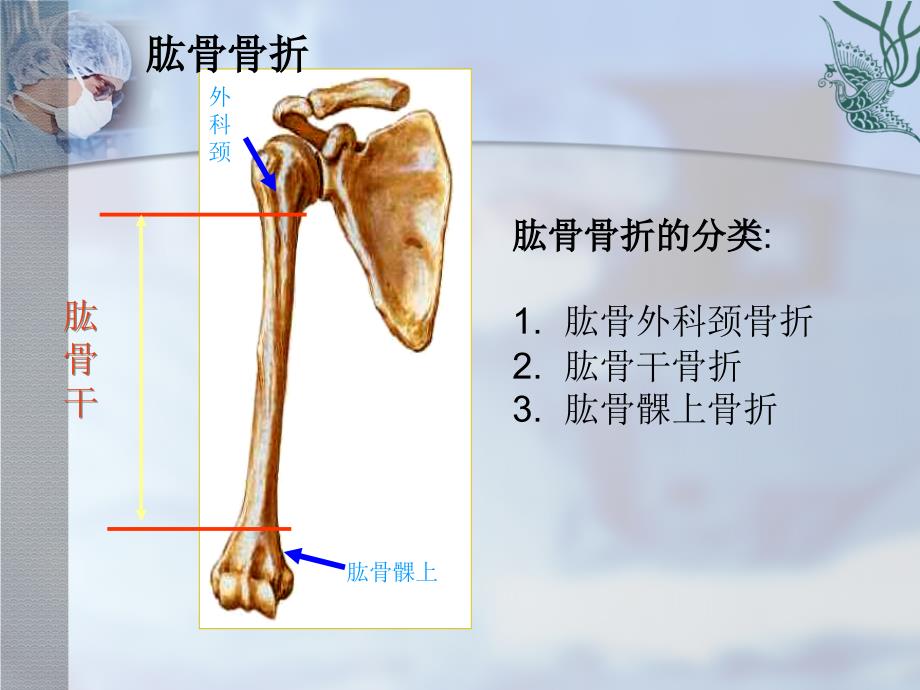 肱骨骨折的护理ppt课件.ppt_第3页