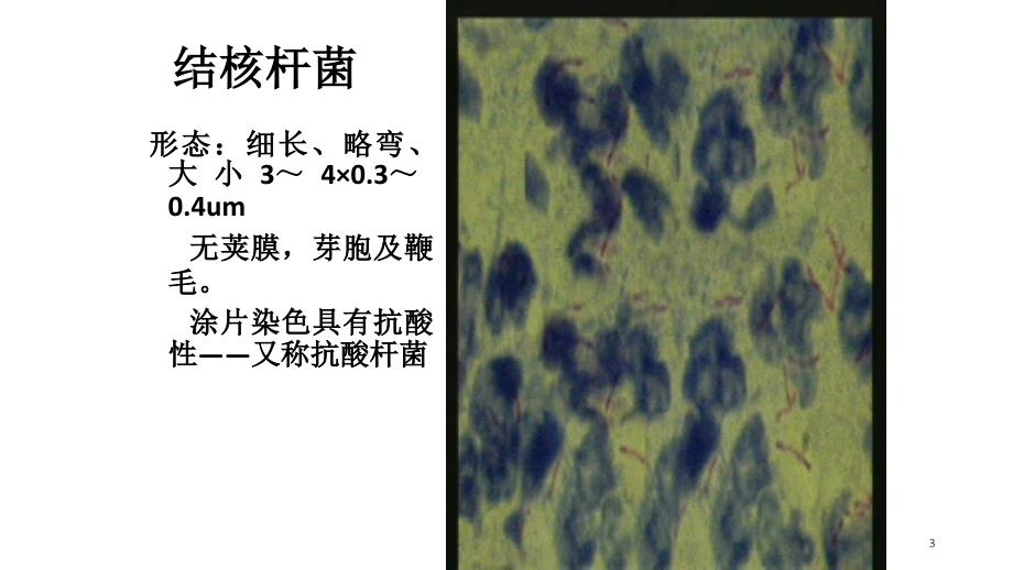 预防结核病PPT课件.ppt_第3页