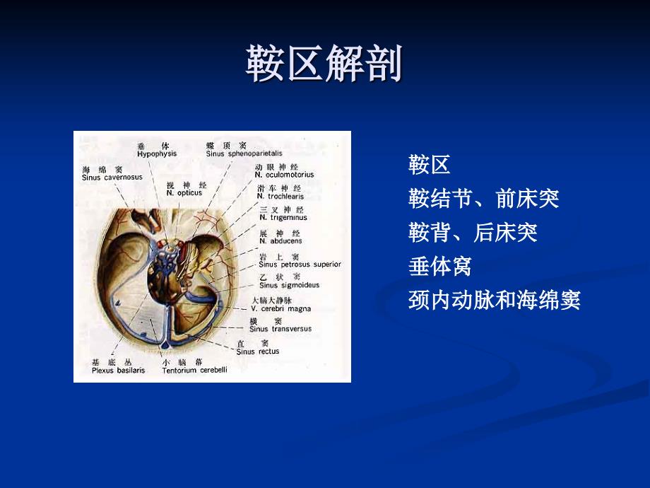 鞍区肿瘤医学PPT.ppt_第3页