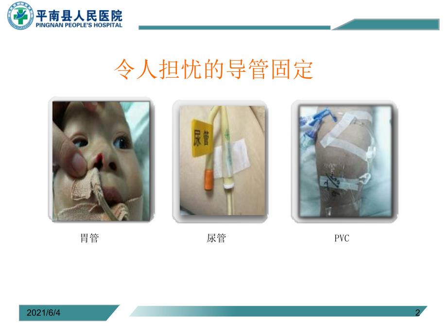 静疗培训常见各种导管的固定方法.ppt_第2页