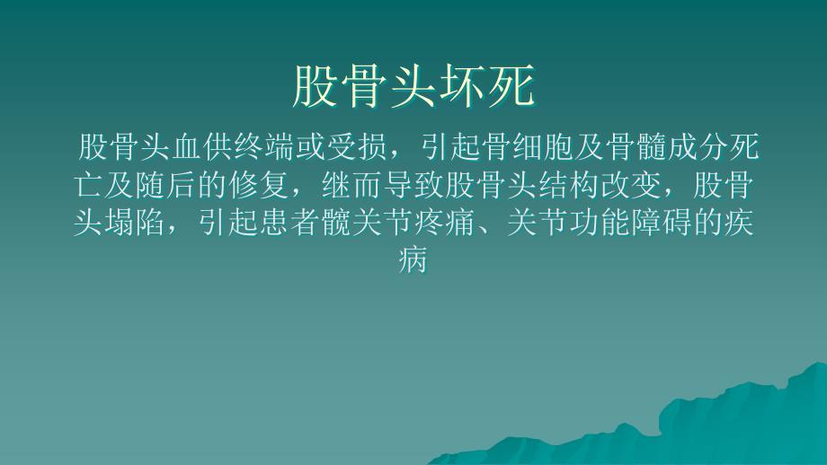 股骨头坏死诊治.ppt_第2页